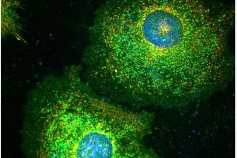 Le cellule tumorali diventano zombie per sfuggire alla chemioterapia